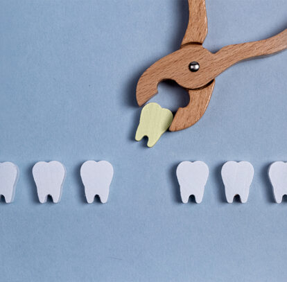 Tooth Abscess Stages: Causes, Symptoms and Treatment