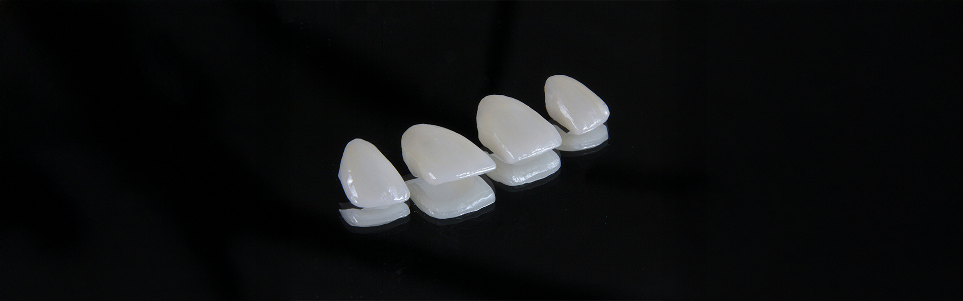 How Long Do Veneers Last? A Realistic Look at Durability
