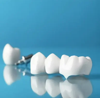 How Dental Crowns Protect Weak or Damaged Teeth Long-Term